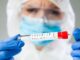 Pros and Cons of Rapid Antigen Test rapid antigen test