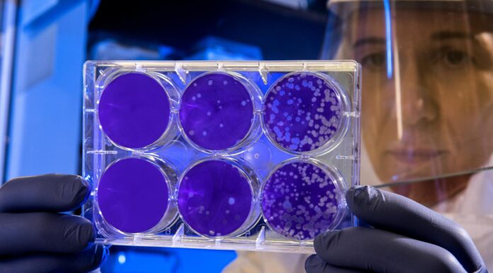 Health Ministry Issues Warning on Potential Entry of Marburg Virus Marburg Virus