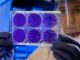 Facts about the Marburg Virus and Its Precautions Marburg Virus