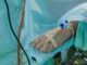 Cytokine Storm Causes Death in Covid-19 Patients? Cytokine Storm