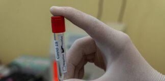 Wow! PCR Tests Price in Indonesia is Almost 10 Times More Expensive than in India PCR Test