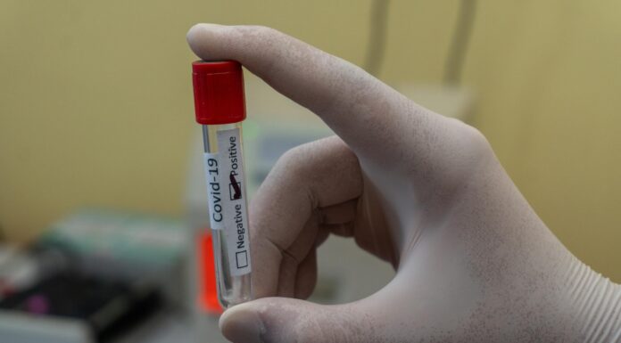 Wow! PCR Tests Price in Indonesia is Almost 10 Times More Expensive than in India PCR Test