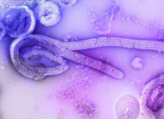 Indonesia Steps Up Vigilance as WHO Raises Global Alert Over Ebola Outbreak Indonesia Steps Up Vigilance as WHO Raises Global Alert Over Ebola Outbreak