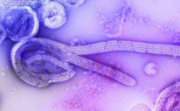 Indonesia Steps Up Vigilance as WHO Raises Global Alert Over Ebola Outbreak Indonesia Steps Up Vigilance as WHO Raises Global Alert Over Ebola Outbreak