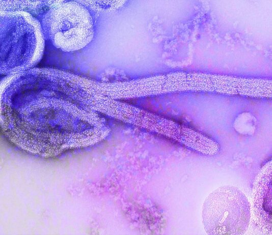 Indonesia Steps Up Vigilance as WHO Raises Global Alert Over Ebola Outbreak Indonesia Steps Up Vigilance as WHO Raises Global Alert Over Ebola Outbreak