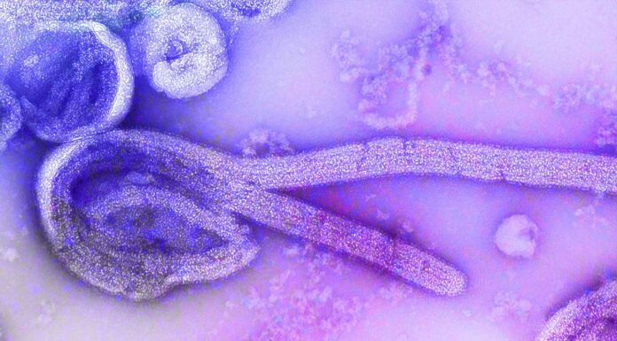 Indonesia Steps Up Vigilance as WHO Raises Global Alert Over Ebola Outbreak Indonesia Steps Up Vigilance as WHO Raises Global Alert Over Ebola Outbreak