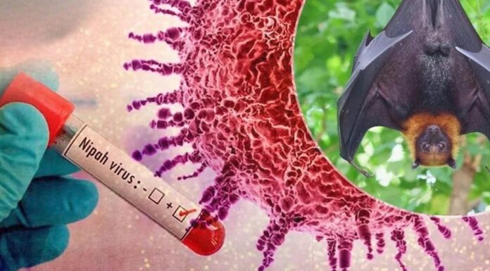 Bali Tightens Airport Surveillance as Nipah Virus Cases Rise Abroad Bali Tightens Airport Surveillance as Nipah Virus Cases Rise Abroad